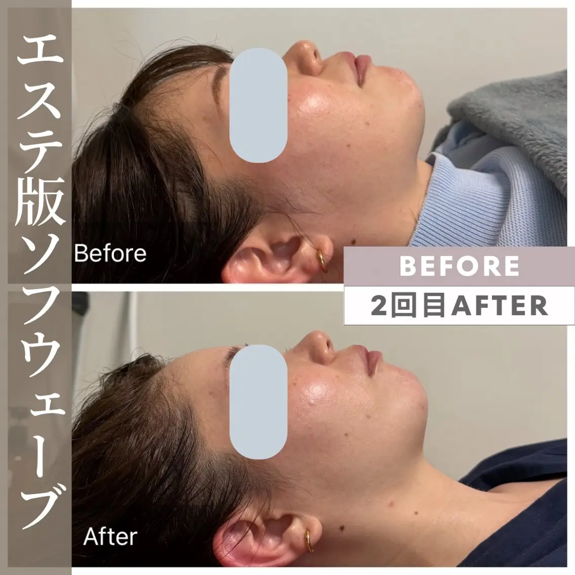 エステ リラク 小顔矯正・美肌ケア 池田 桃花のエステ・リラクイメージ
