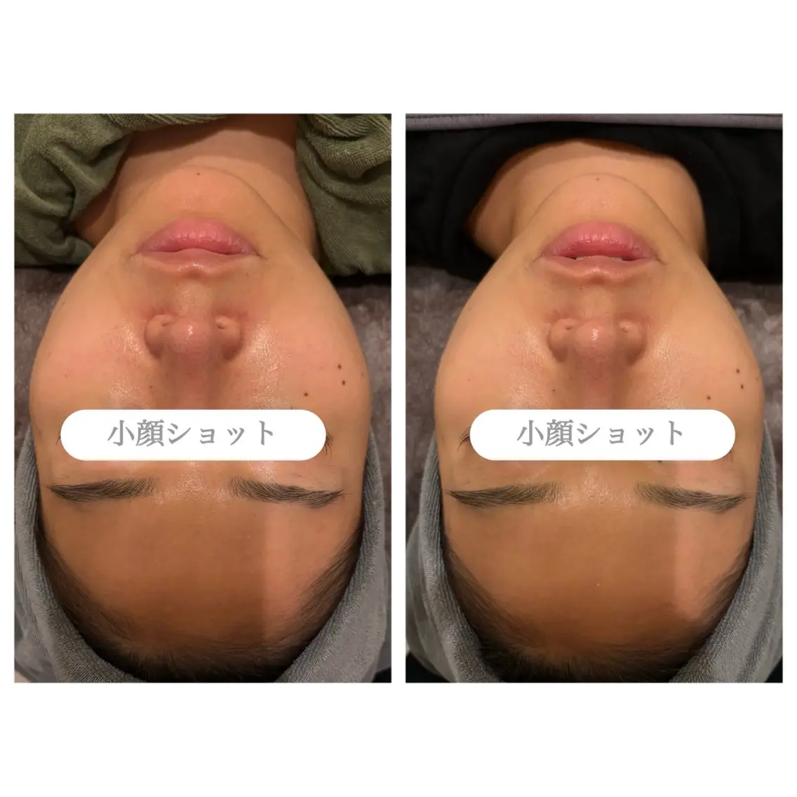 エステ 表参道エステ痩身 hiromiのエステ・リラクイメージ