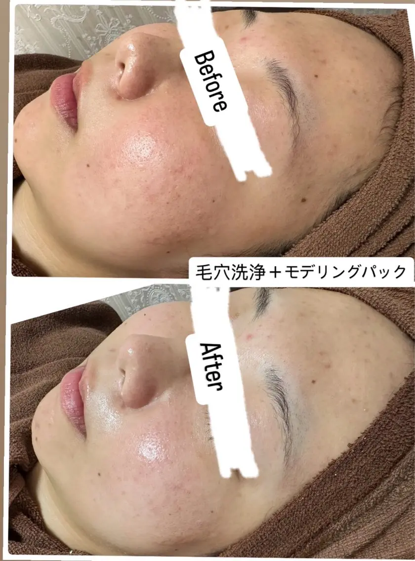 その他 ブリリエット 楠井のエステ・リラクイメージ