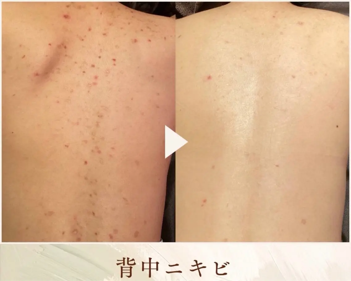 エステ Jewelry bodyのエステ・リラクイメージ