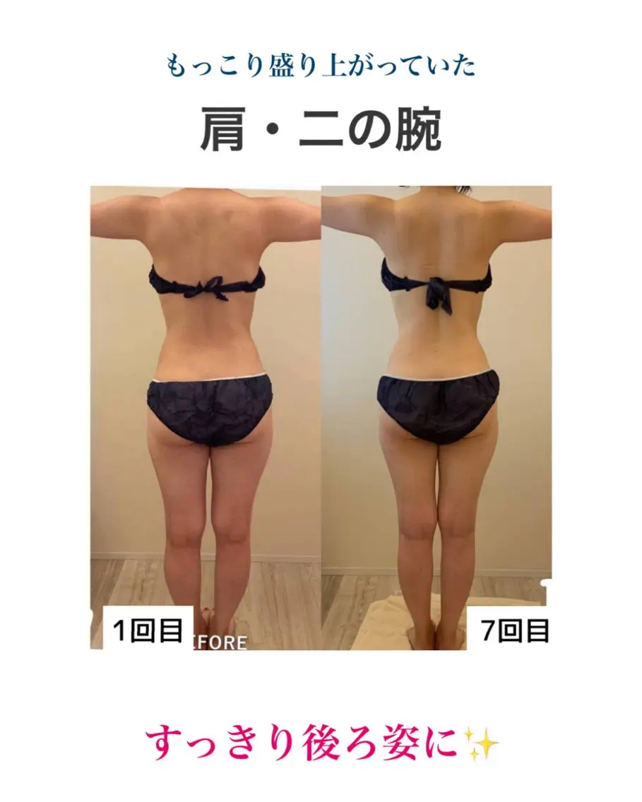 産後ダイエット−9㎏ Pourvous結衣のエステ・リラクイメージ