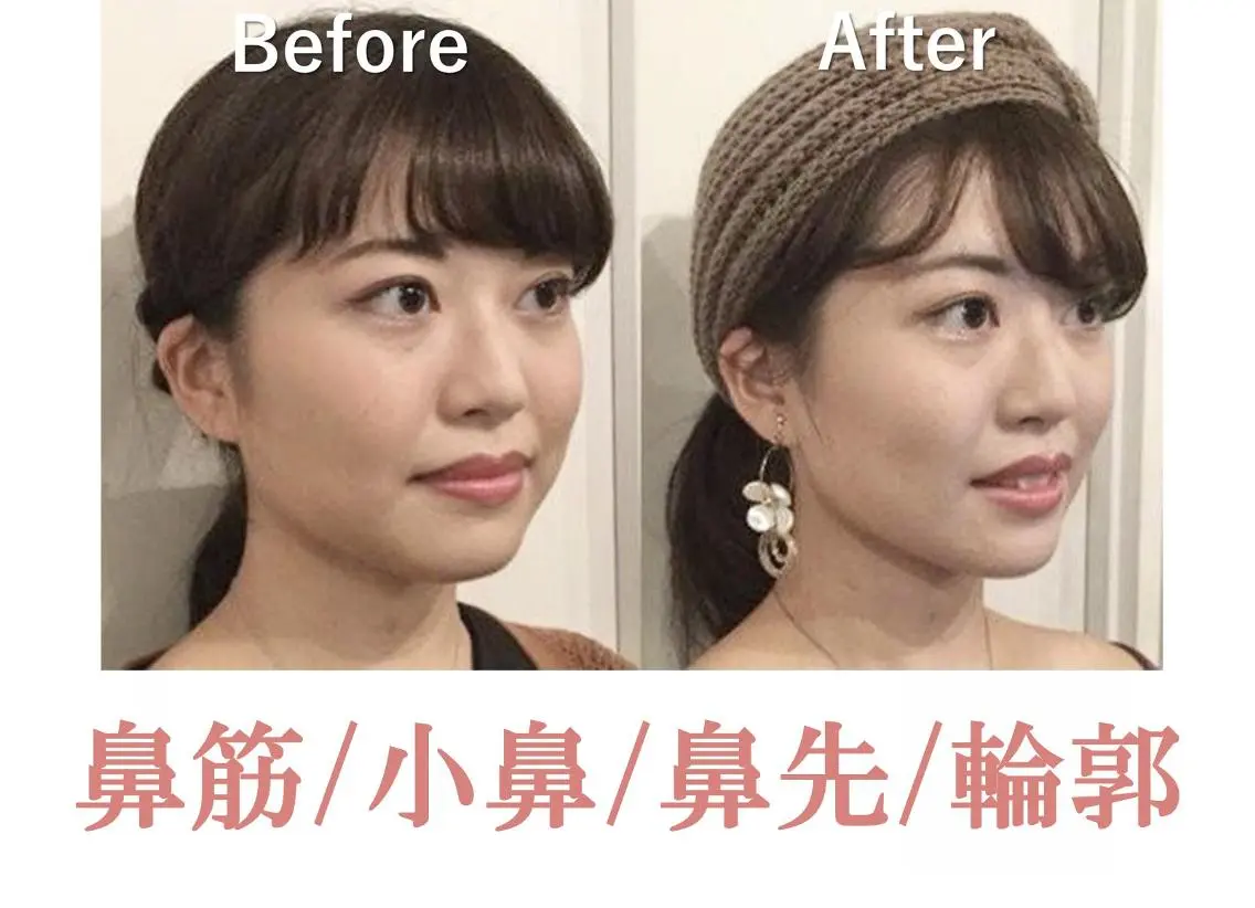 美鼻&小顔専門店 ラプリ　川村のエステ・リラクイメージ