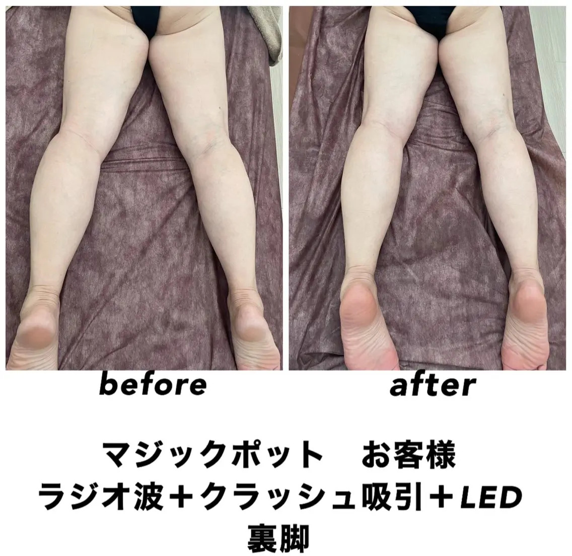 エステ リラク ネイル・エステサロン UILANIのエステ・リラクイメージ