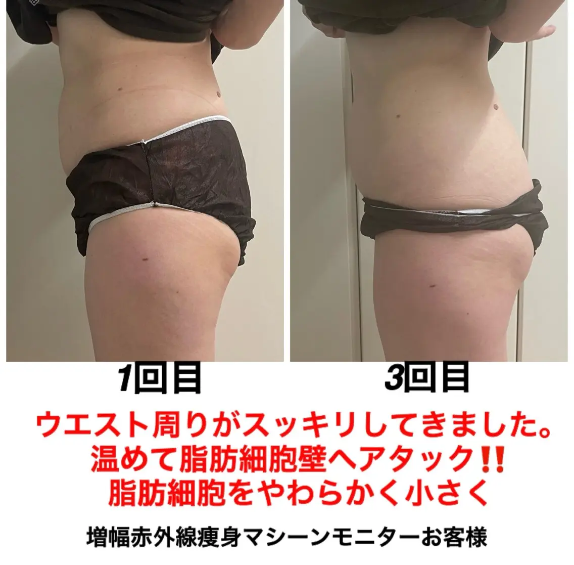 ネイル・エステサロン UILANIのエステ・リラクイメージ