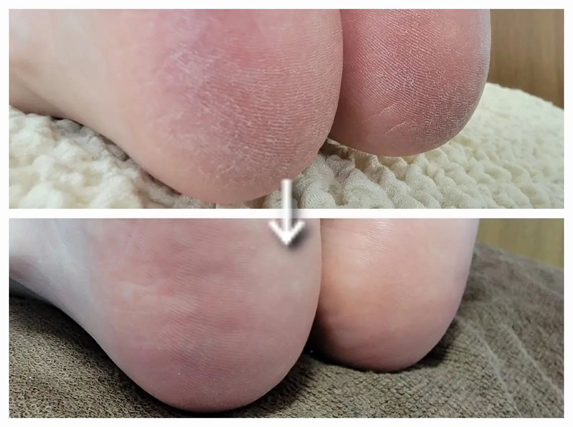 ネイル&巻き爪サロン AKnailのネイルデザイン