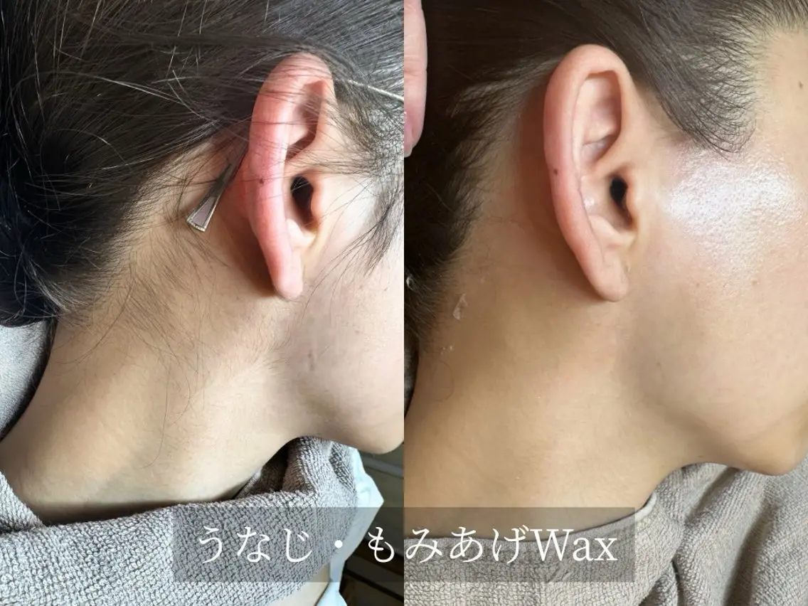 脱毛 脱毛サロン Arumのエステ・リラクイメージ