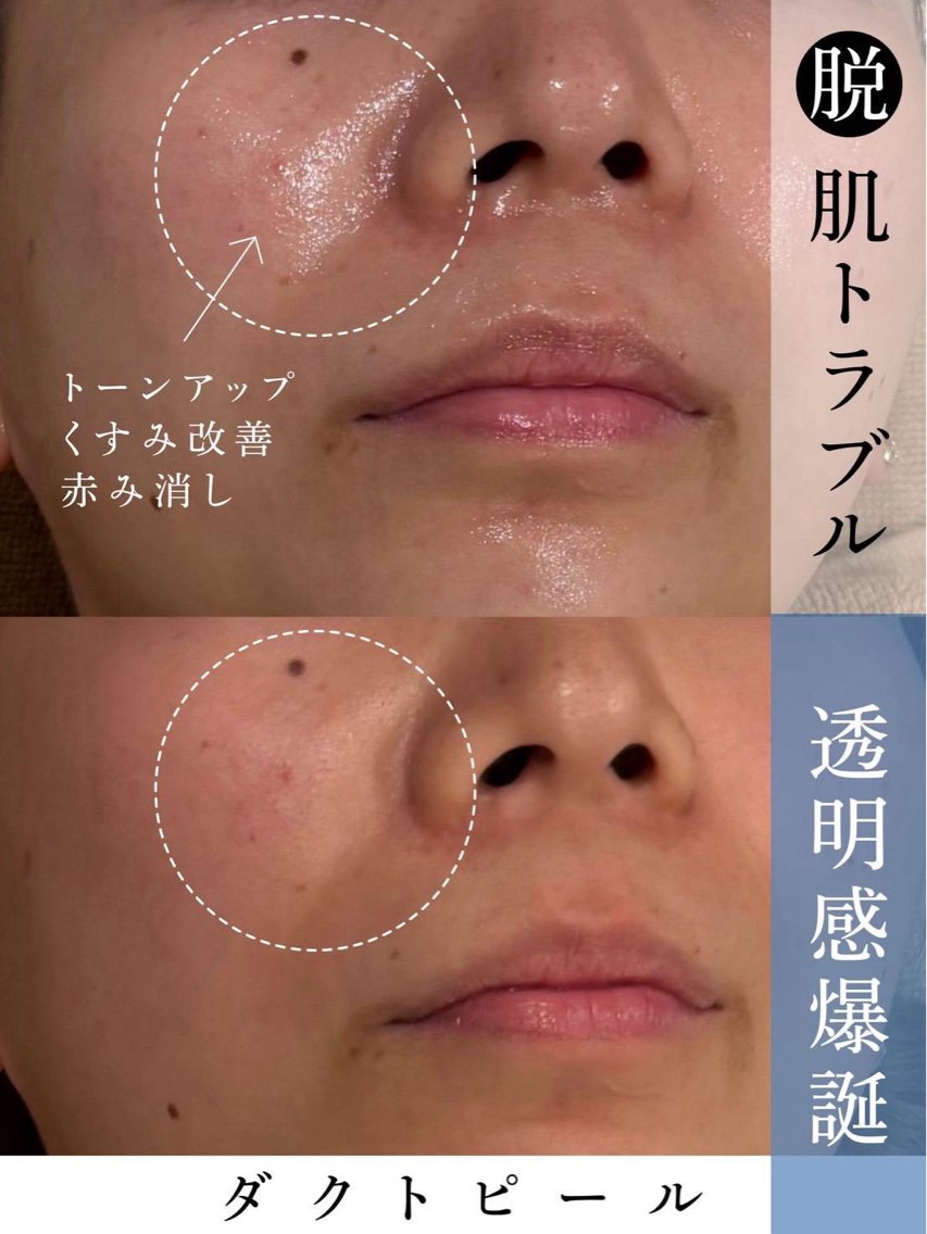 エステ Lilyboo 池袋のエステ・リラクイメージ