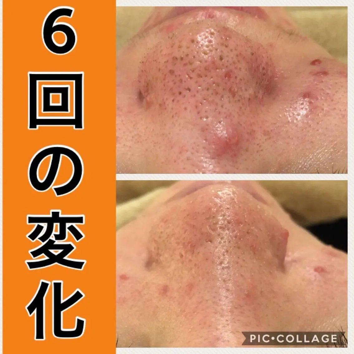 ミディアム パーマ ヘアアレンジ メンズ キッズ ネイル マツエク・マツパ ニキビ・肌質改善専門 ♡人生が変わるサロンのエステ・リラクイメージ