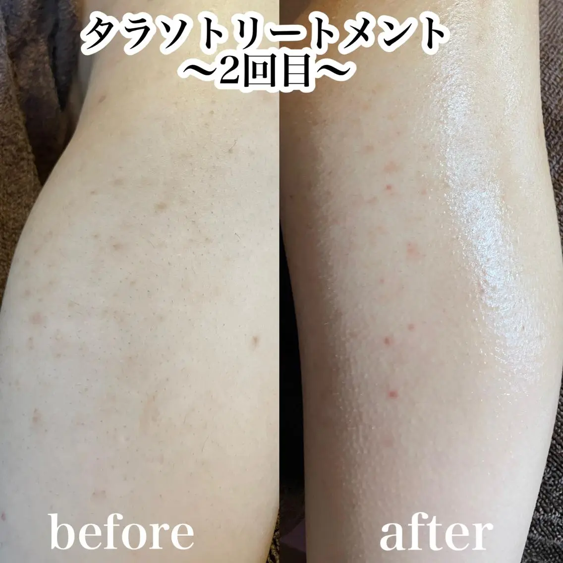 エステ 浜野 恵美のエステ・リラクイメージ