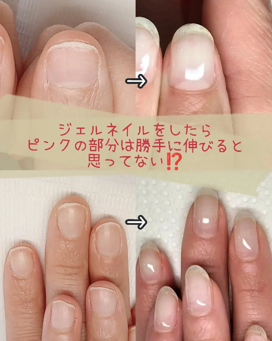 自爪育成クリアジェル【長さ整え＋甘皮処理(ウォーターケア)＋クリアジェル塗布】の写真