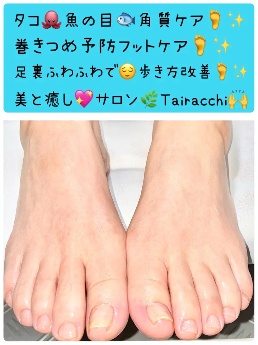 ネイル フットネイル Tairacchi ﾀｲﾗｯﾁのエステ・リラクイメージ
