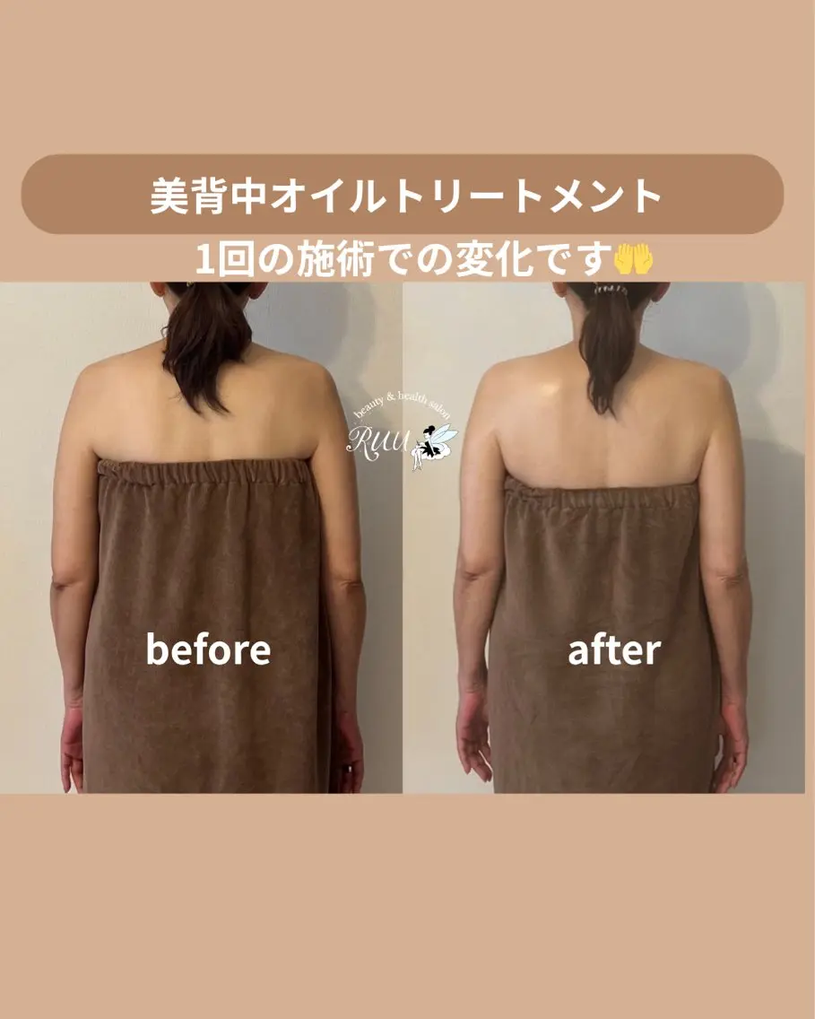 【頭痛、睡眠改善】 salon RUUのエステ・リラクイメージ