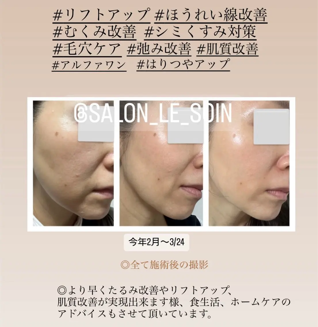 エステ 潤い艶肌・身体ケア /貸切りサロンソワンのエステ・リラクイメージ