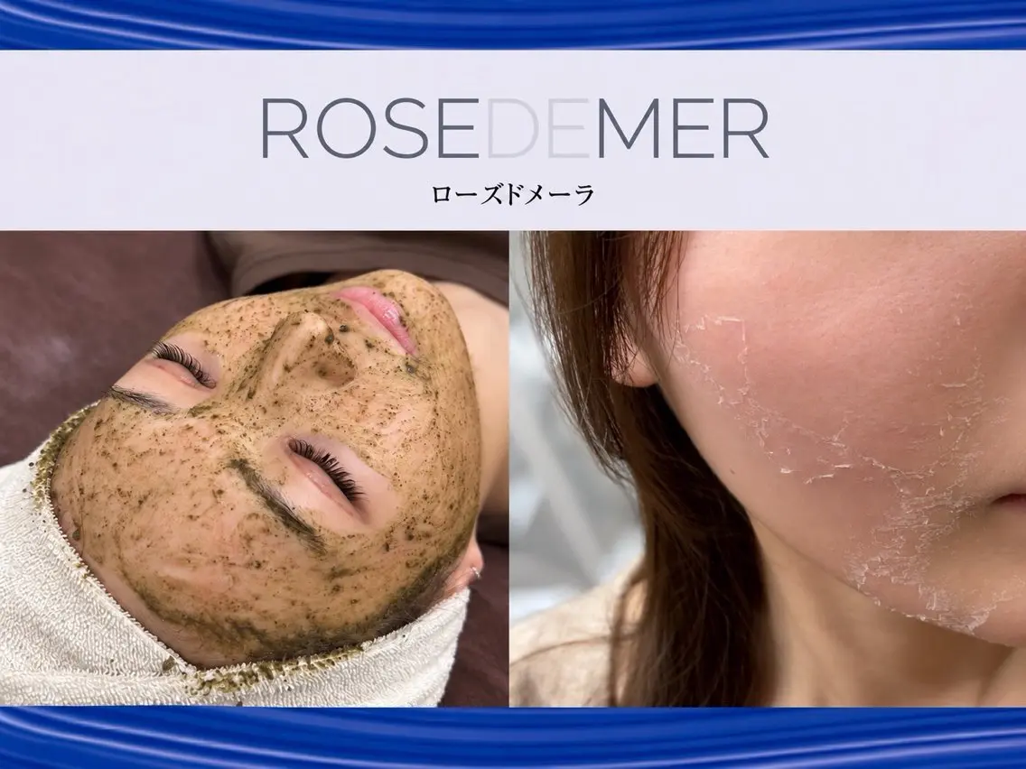 【劇的美肌改革×圧倒的変化】ローズドメーラ剥離ハーブピーリングの写真