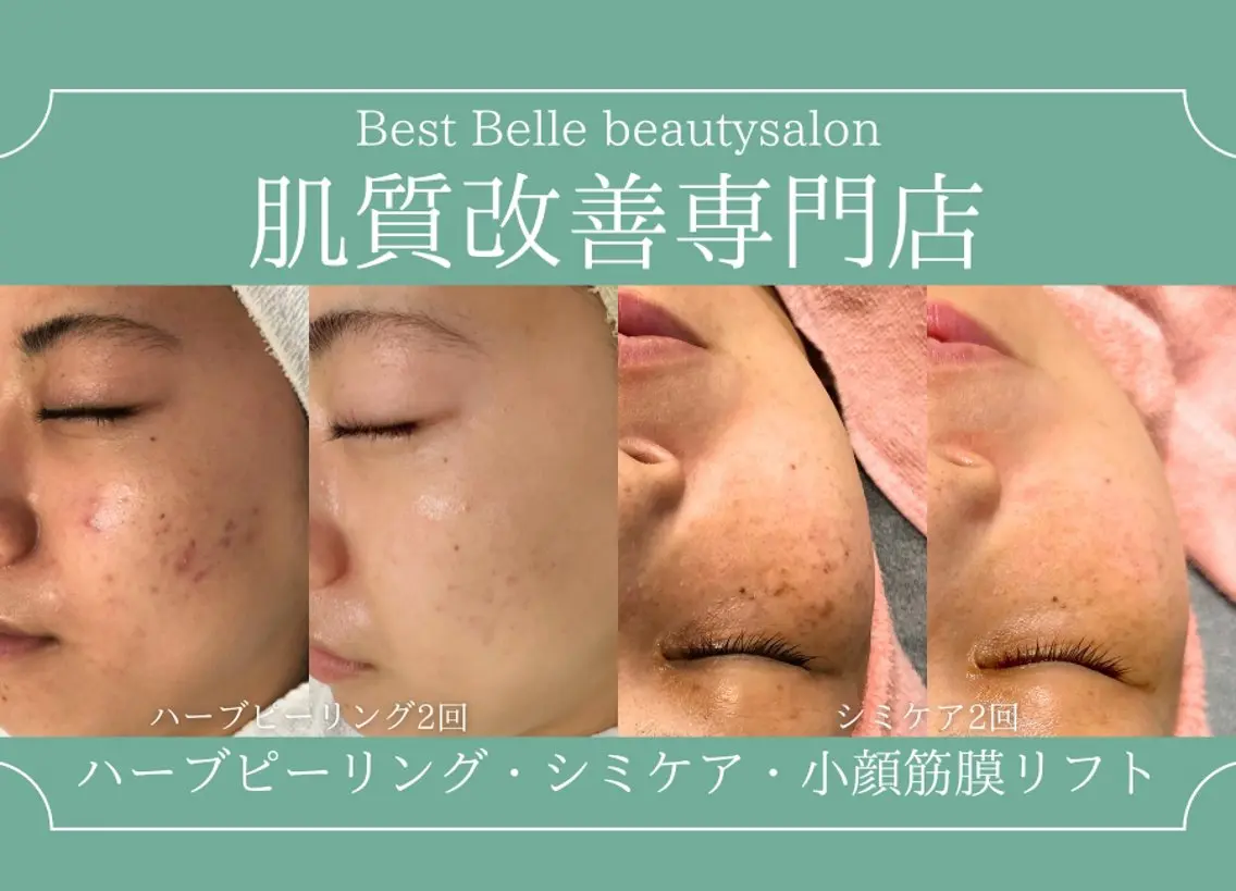 肌質改善サロン BestBelleのエステ・リラクイメージ