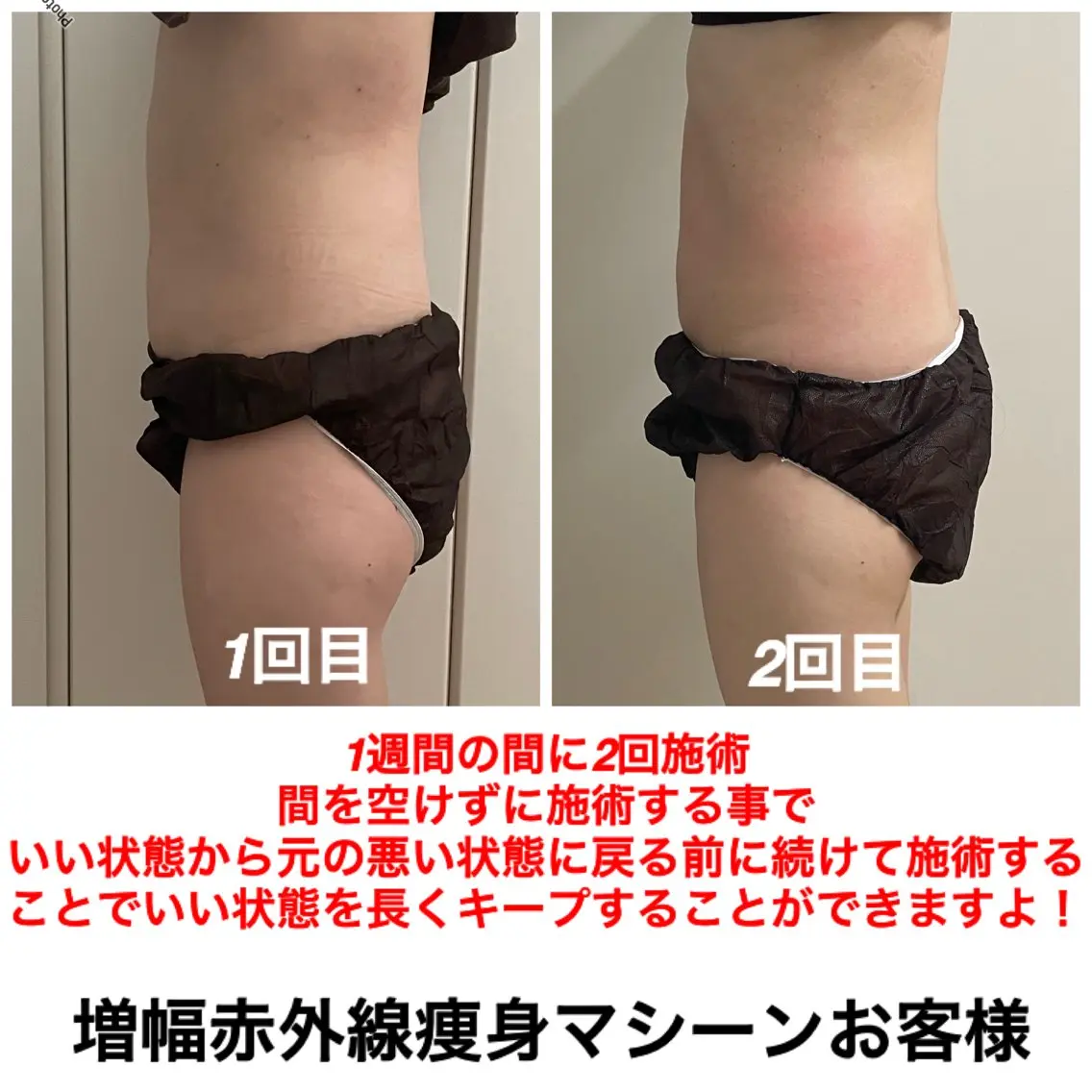 エステ ネイル・エステサロン UILANIのエステ・リラクイメージ