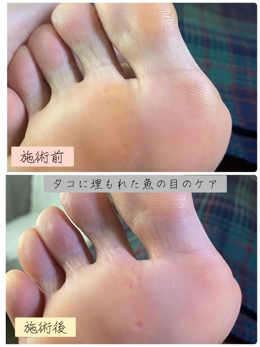 ネイル フットネイル フットネイル Studio Jivanのネイルデザイン