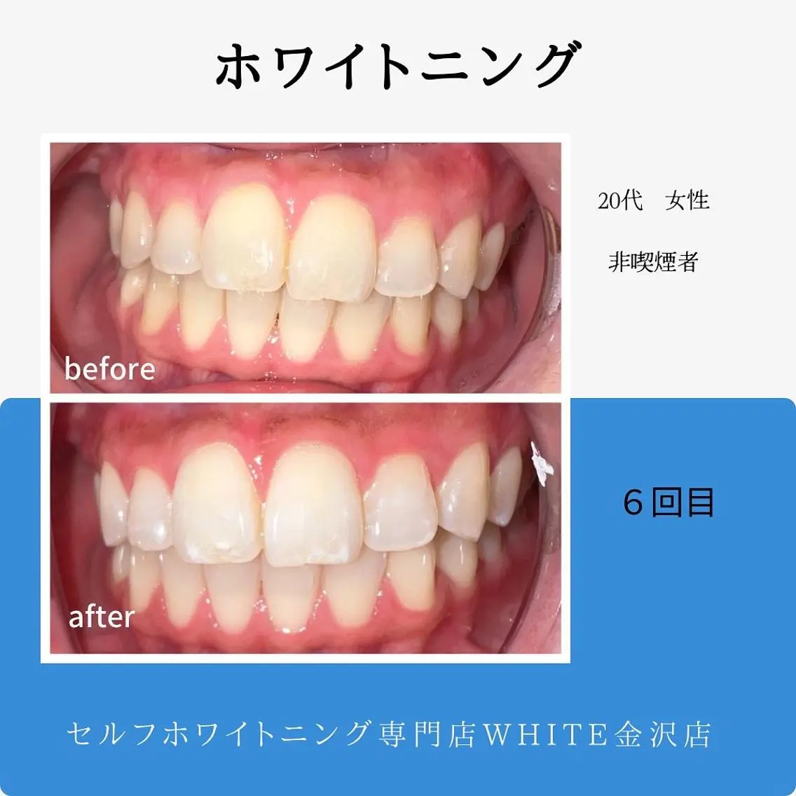 伊藤 勢のエステ・リラクイメージ
