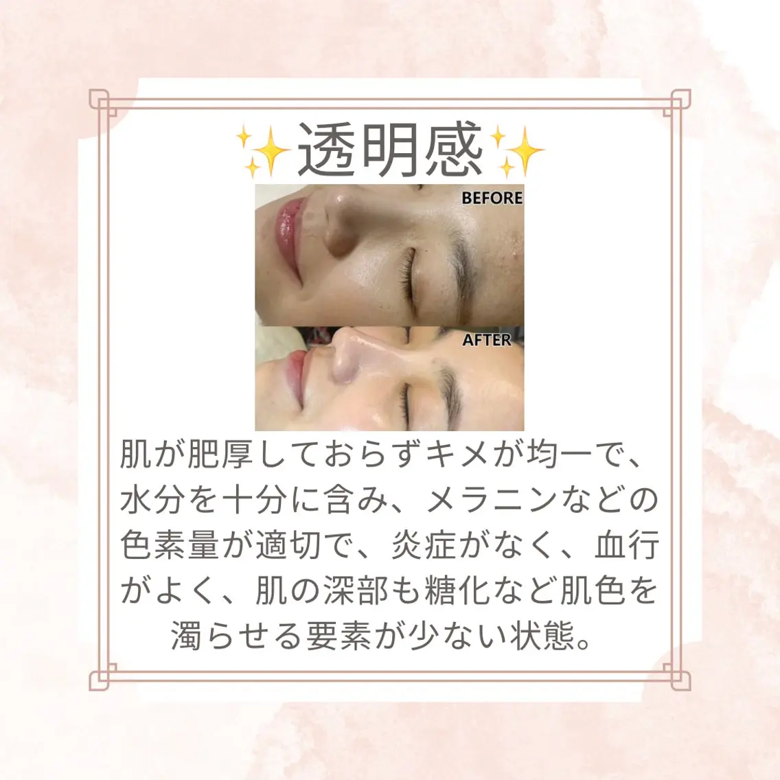 エステ リラク 愛維美水光美肌専門店 メンズレディースokのエステ・リラクイメージ