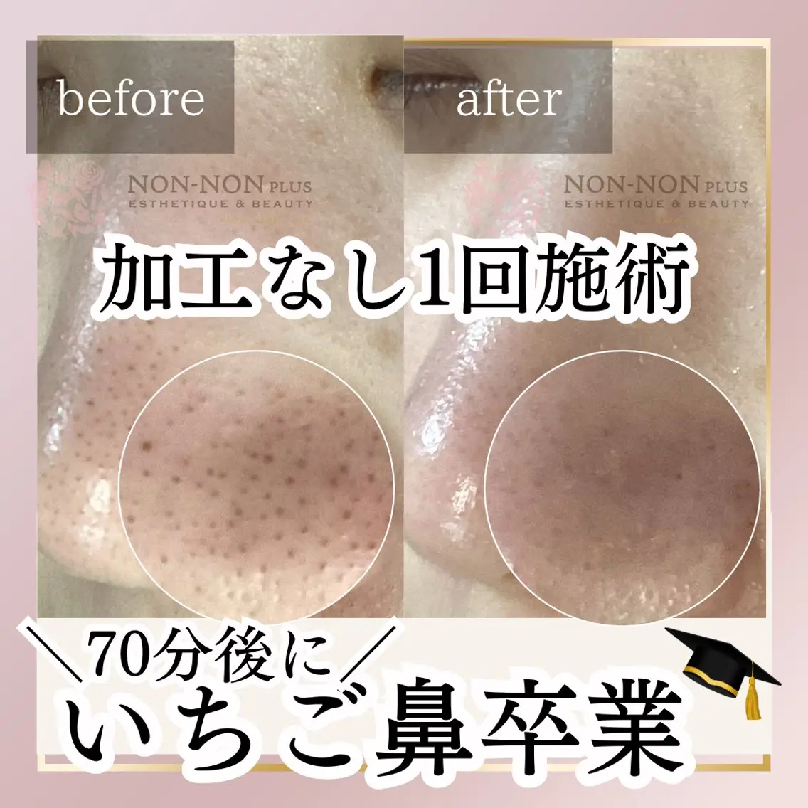 NON-NONプラス 大人の本気痩身のエステ・リラクイメージ