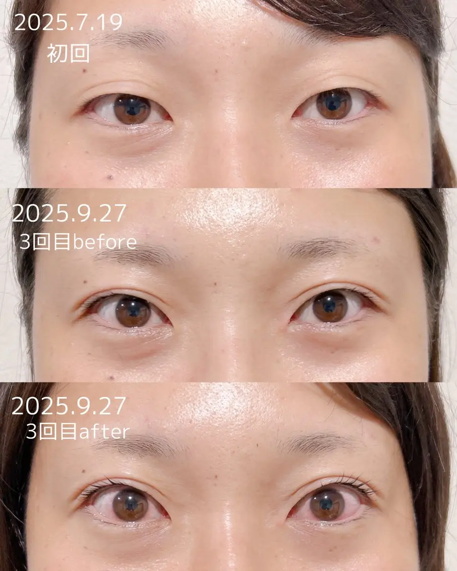 マツエク・マツパ アイリッドアップパーマ 一重×まつ毛パーマ マツパ まつげ/整体/にきび ・アトピー専門サロンのマツエク・マツパデザイン