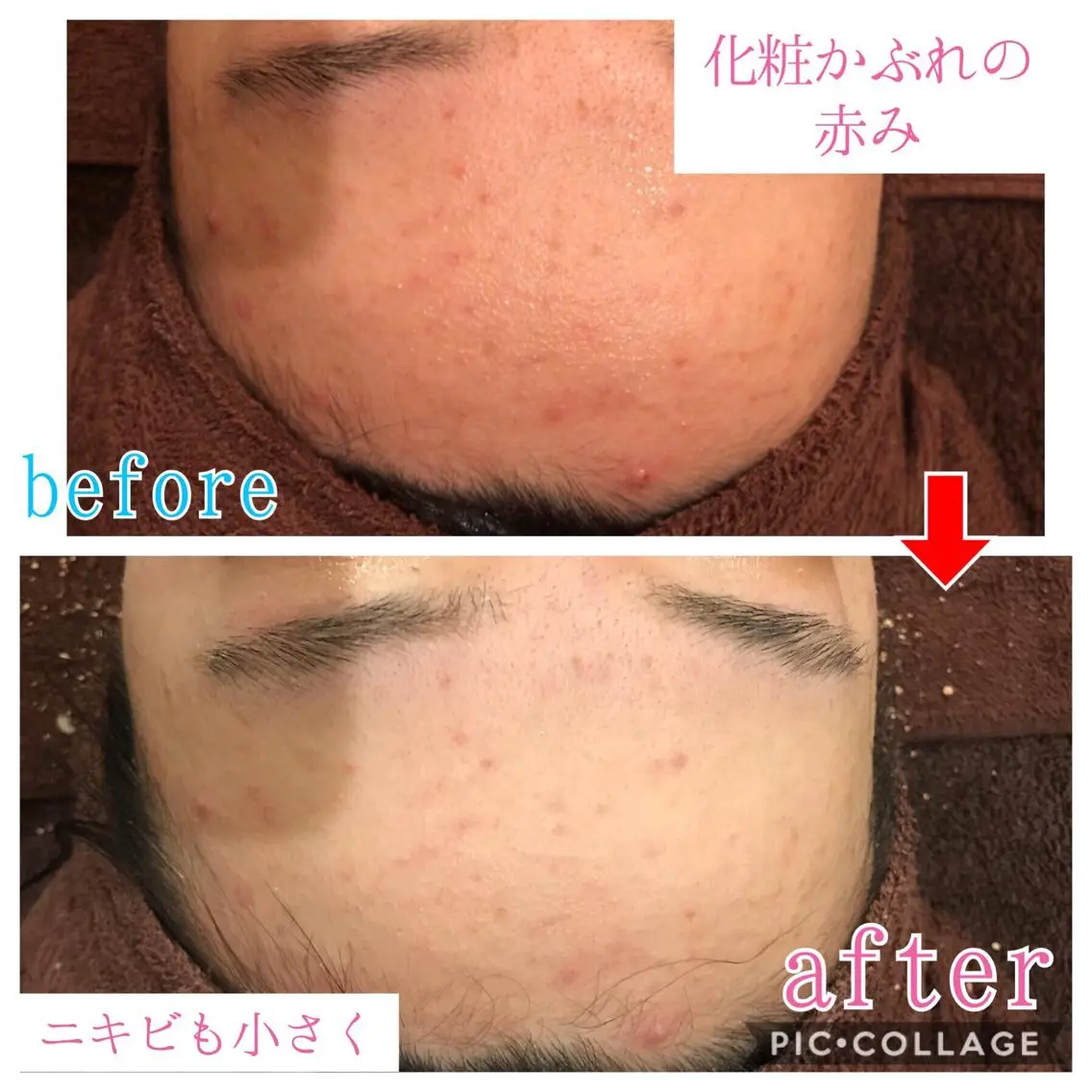 ミディアム カラー パーマ ヘアアレンジ メンズ キッズ ネイル マツエク・マツパ 金の糸脱毛 産毛ケア専門のエステ・リラクイメージ