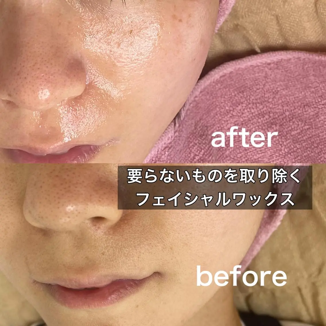 ツヤ、ピカ✨️内側から発光するお肌へ～美肌wax＆LEDライト*お写真モデルの写真