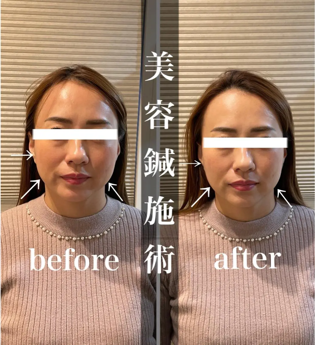 鍼灸 Refineのその他イメージ
