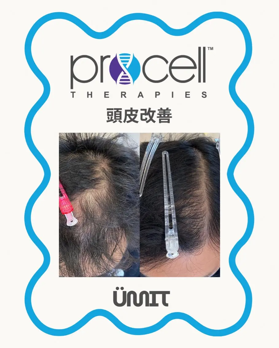 メンズ ヘッドスパ Ümit（ユミト） プロセルセラピーズのネイルデザイン