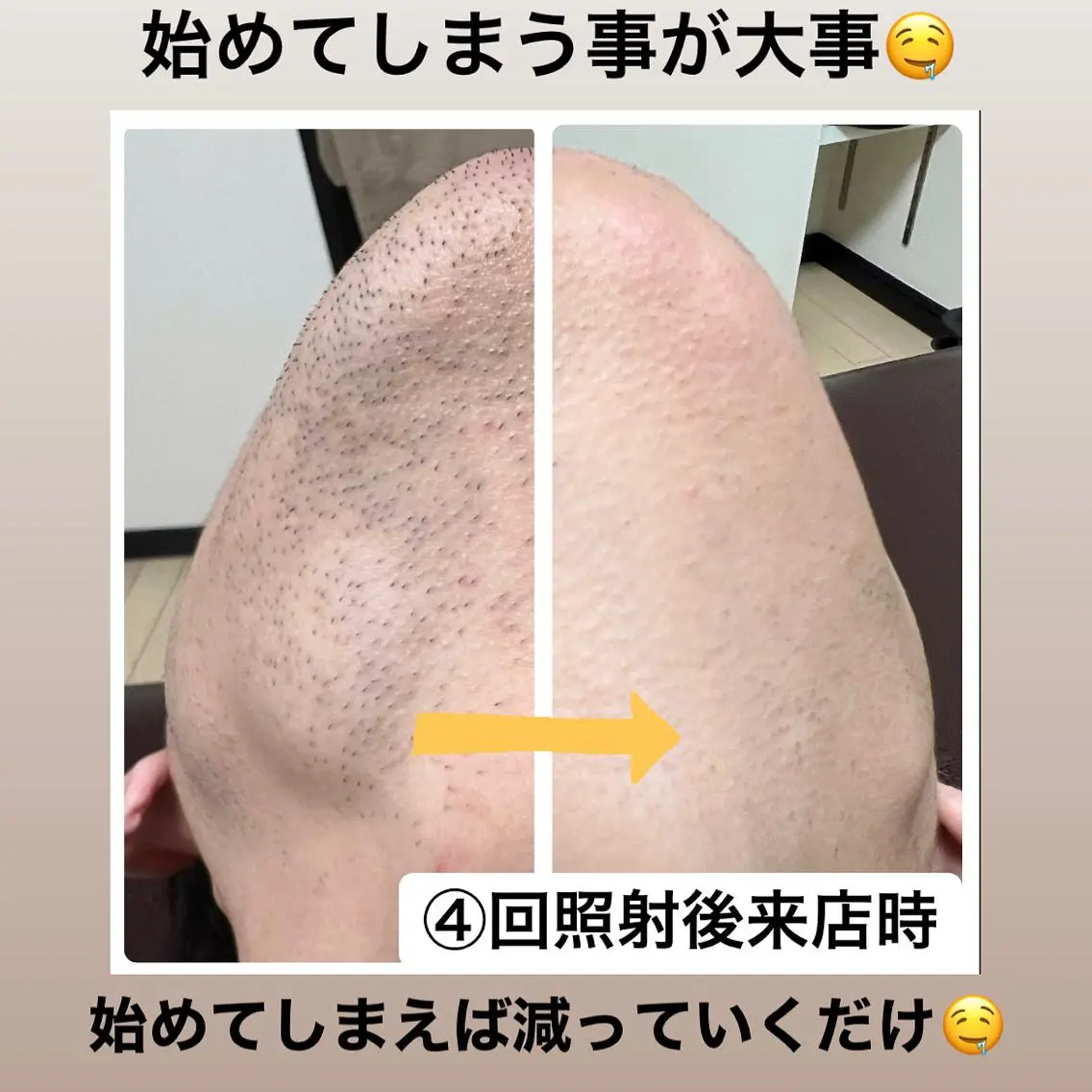 メンズ メンズハイライト メンズ脱毛サロン Le falcoのエステ・リラクイメージ