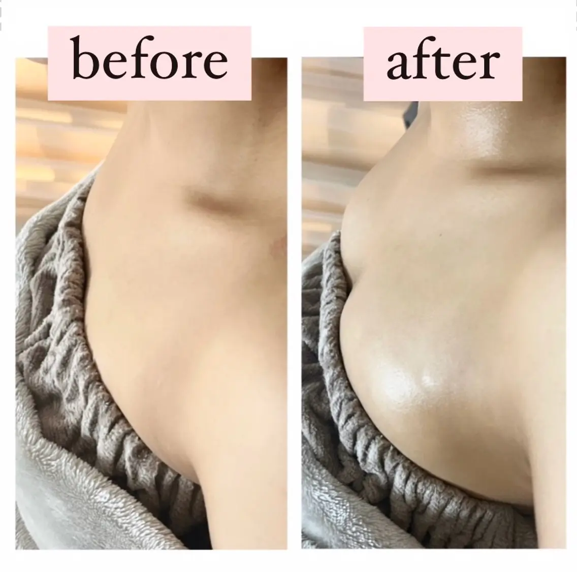 下垂・離れ乳・削げデコルテに◎ふっくら上向き美バストへ✨姿勢・デコルテから整えるバストケアで自然なボリューム感へ♪の写真