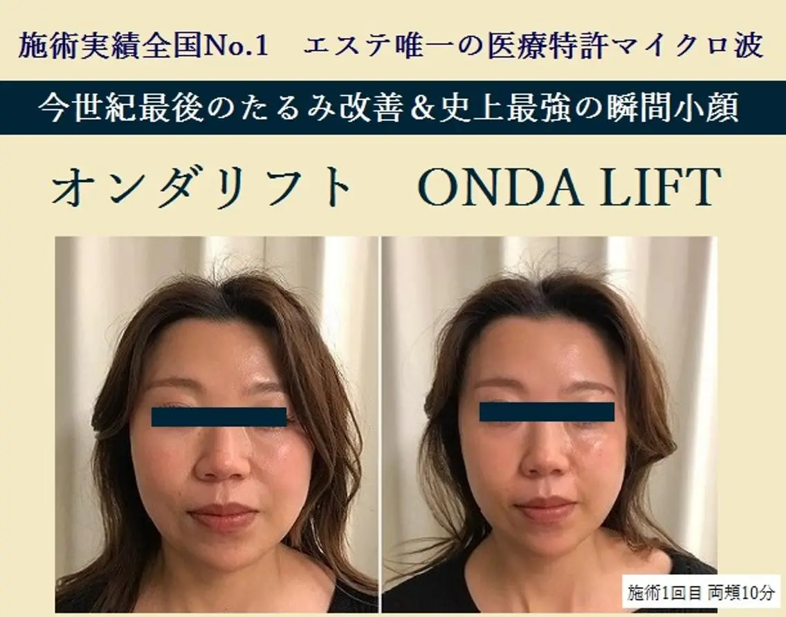 小顔&たるみ&痩身 オンダリフト♪ヒロコのエステ・リラクイメージ