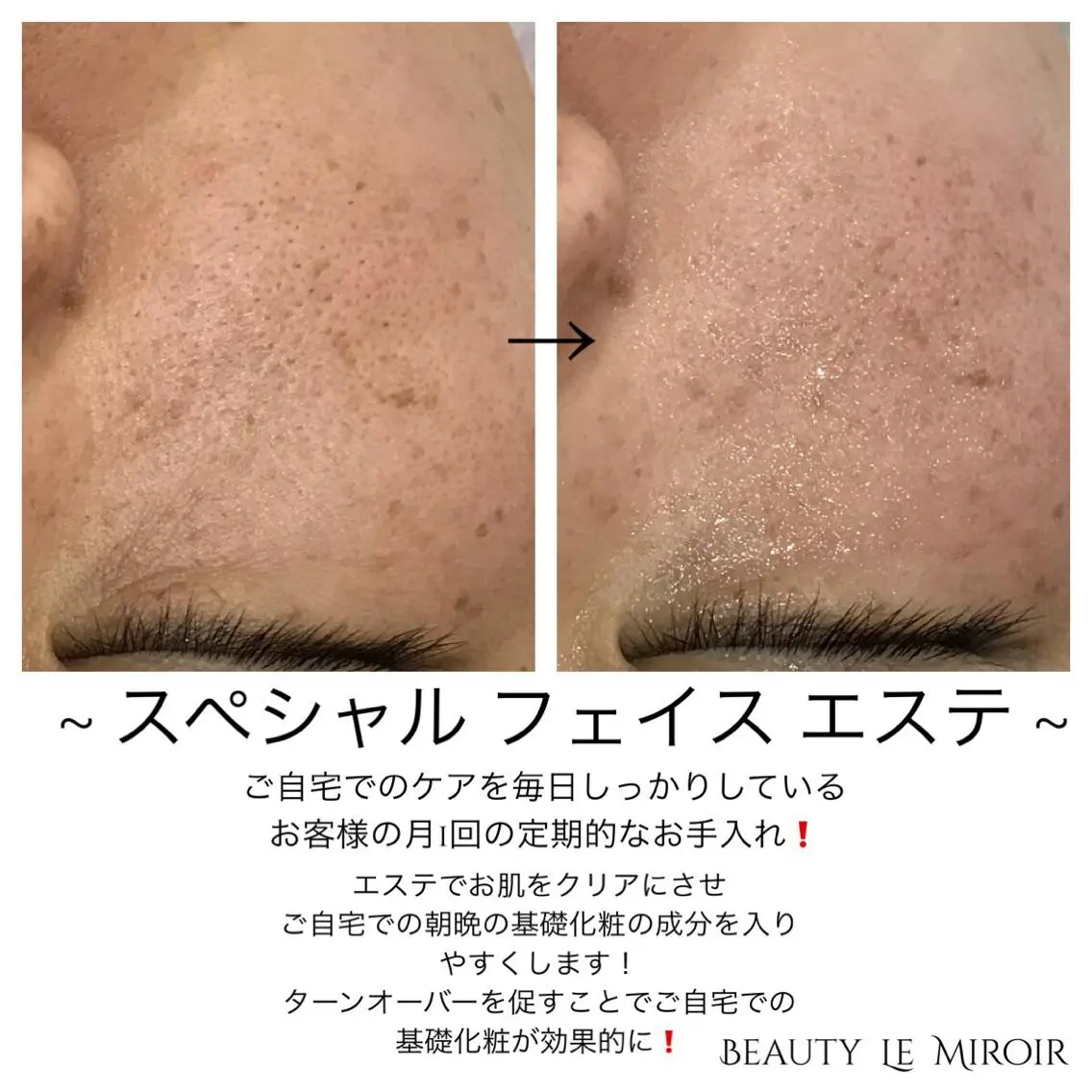 ビューティー ミロワールのエステ・リラクイメージ