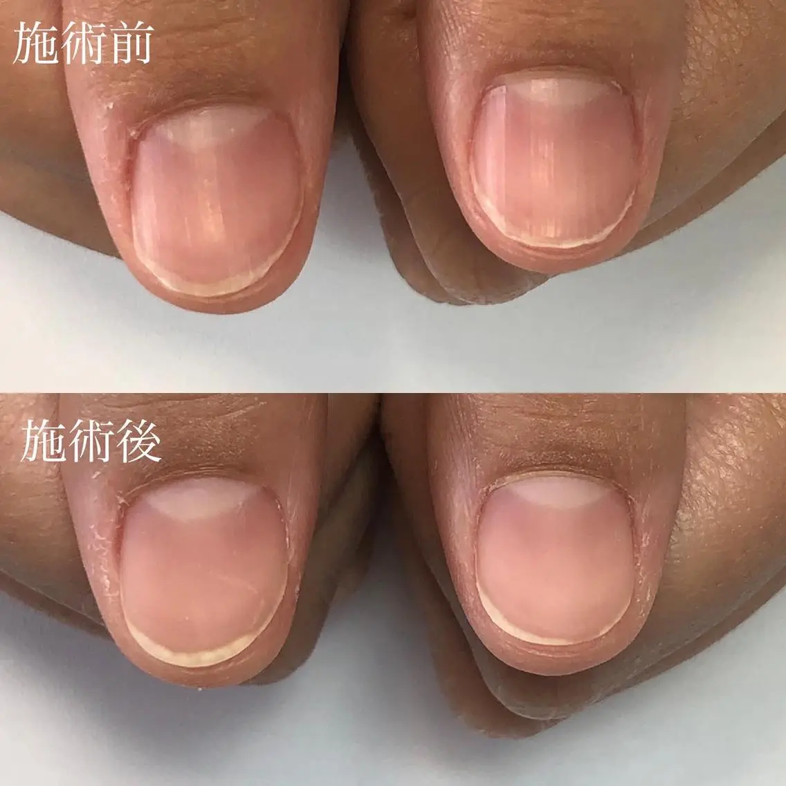 ネイル マットネイル NAIL SALON BOUTONのネイルデザイン