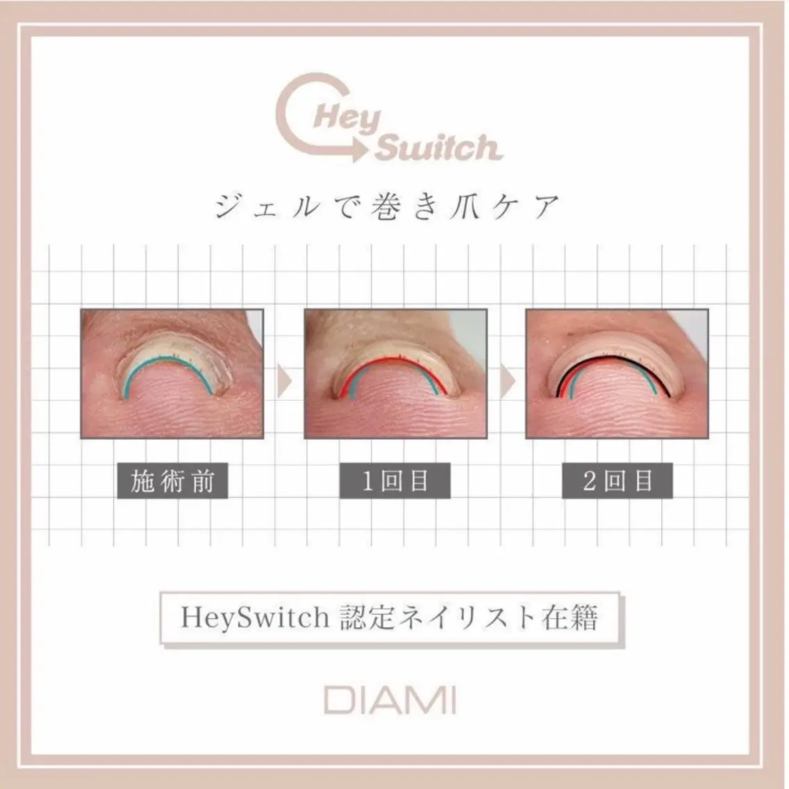 ネイル その他 Aoi ✨ L'ねいるのネイルデザイン