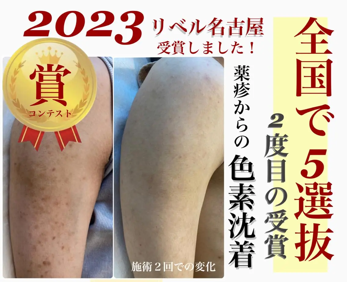パーマ メンズ マツエク・マツパ 次世代まつげパーマは 『リベル名古屋』のマツエク・マツパデザイン