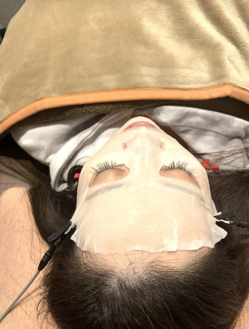 ✨人気№1✨美容鍼SP💗パックで浸透ぷるぷるお肌に🤩の写真