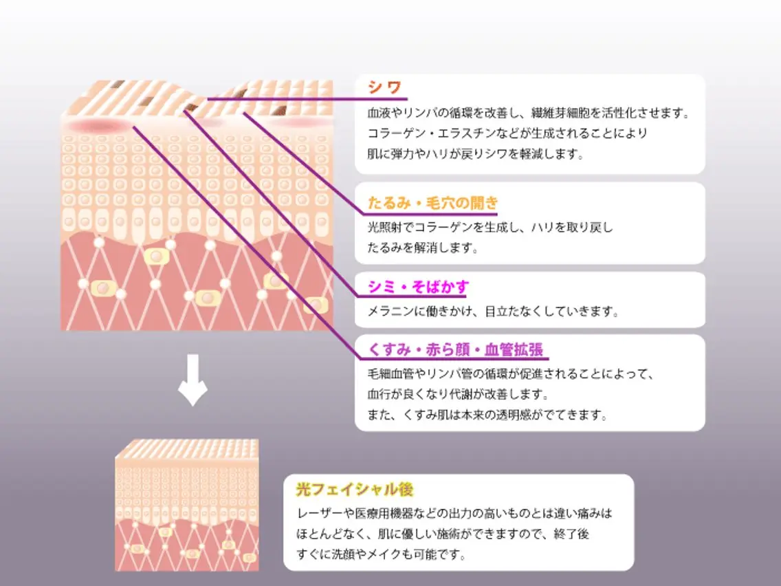 エステ 美肌管理専門Wax/ muroのエステ・リラクイメージ