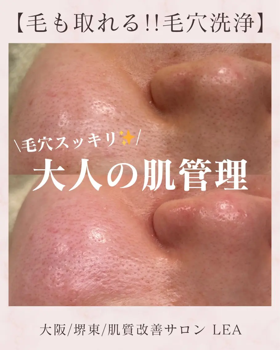 エステ Lea堺東　　眉毛| 毛穴洗浄|顔WAXのその他イメージ