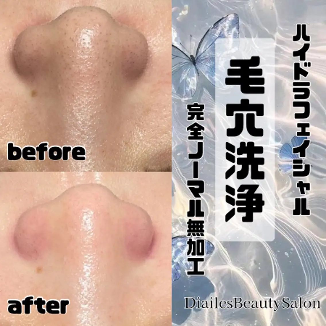 人気No1✨🫧全顔毛穴洗浄🫧毛穴汚れしっかり除去⏰60分の写真