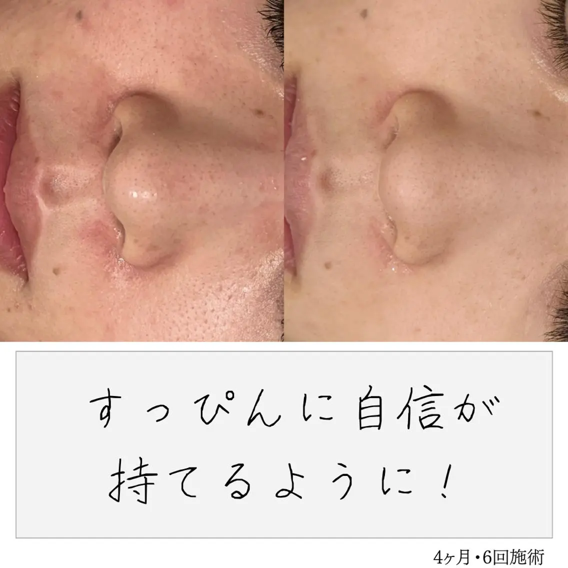 ニキビ経験者が施術 する専門サロン🌻のエステ・リラクイメージ