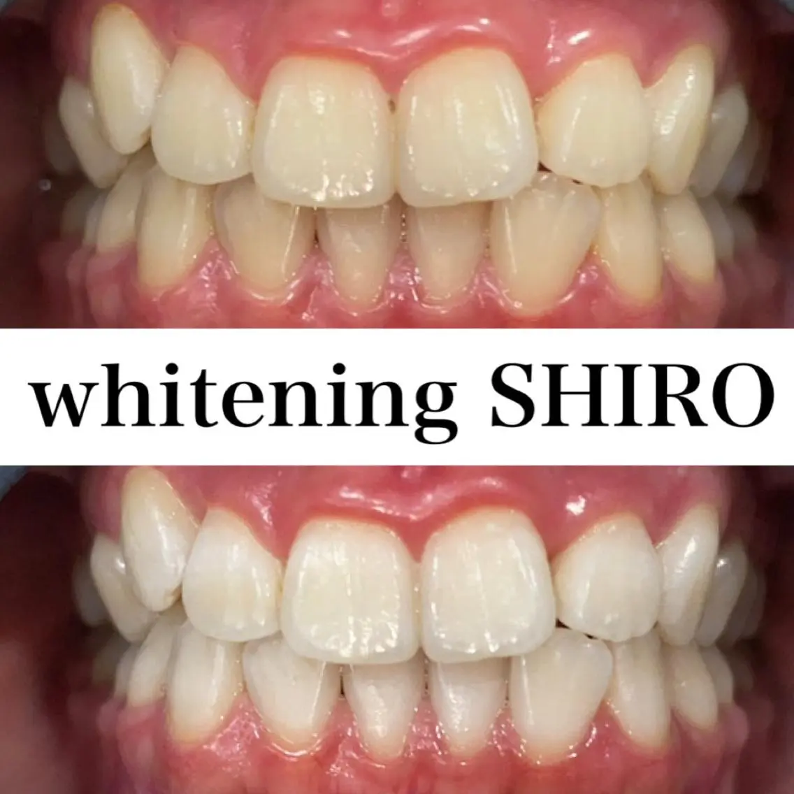 福岡ホワイトニング SHIRO天神店のエステ・リラクイメージ