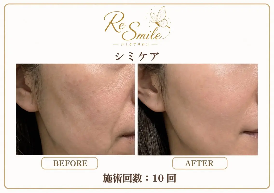 ReSmile (リスマイル)のエステ・リラクイメージ