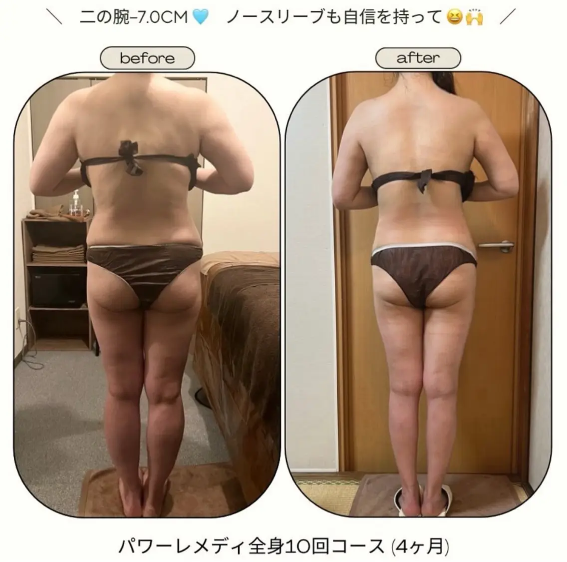 《本気痩せ×疲労改善 》  BILOOPのエステ・リラクイメージ