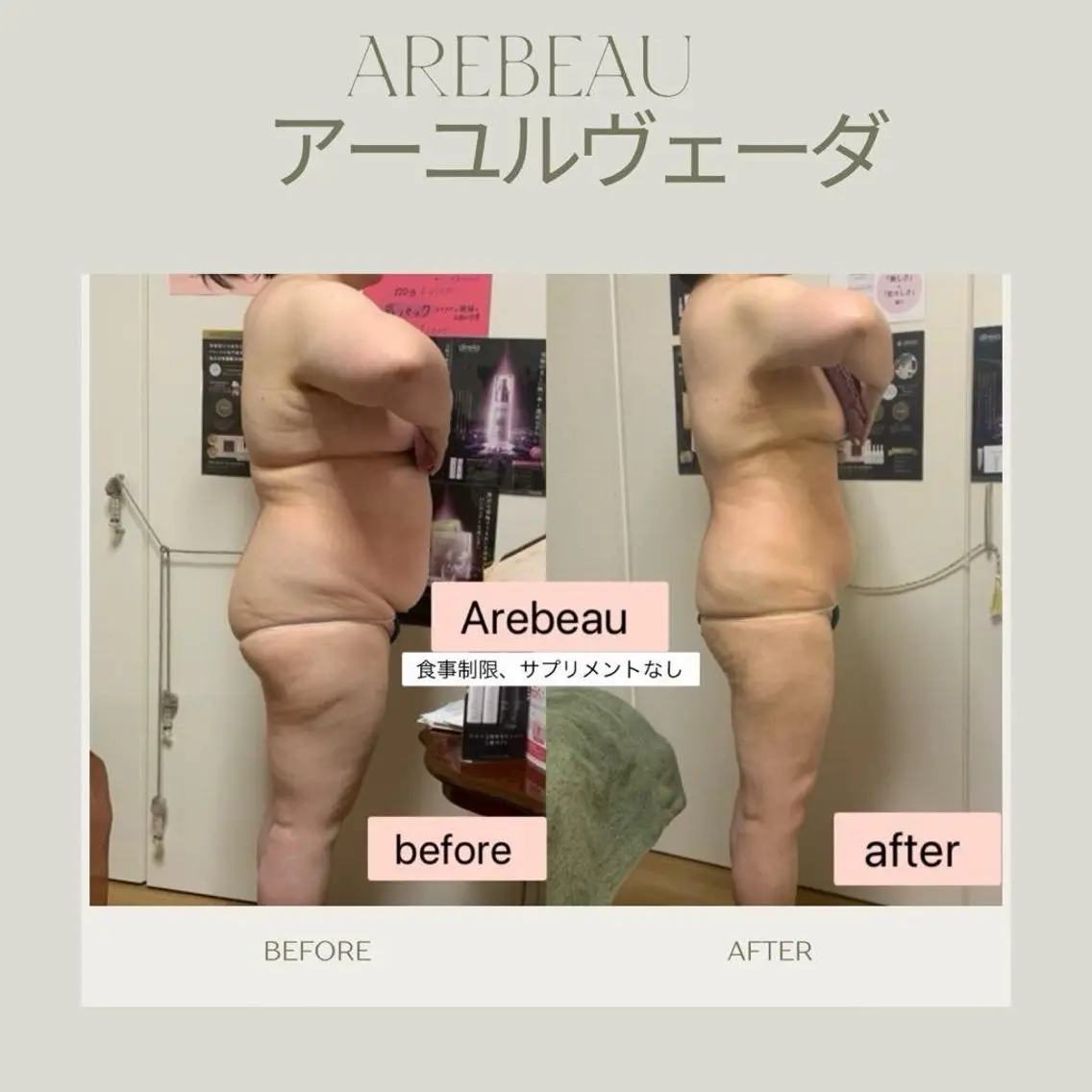 Arebeau 健康的にダイエットのエステ・リラクイメージ