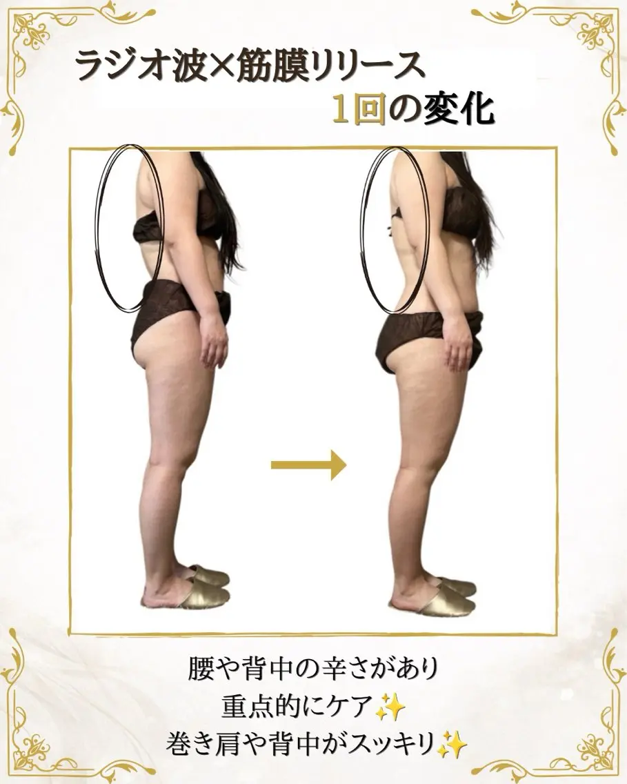 筋膜×深部温熱 リラク★痩身RIONのエステ・リラクイメージ