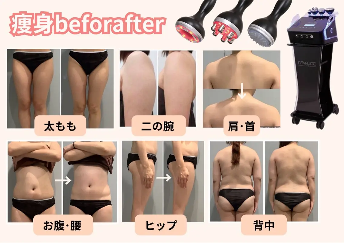 エステサロン JURISのエステ・リラクイメージ