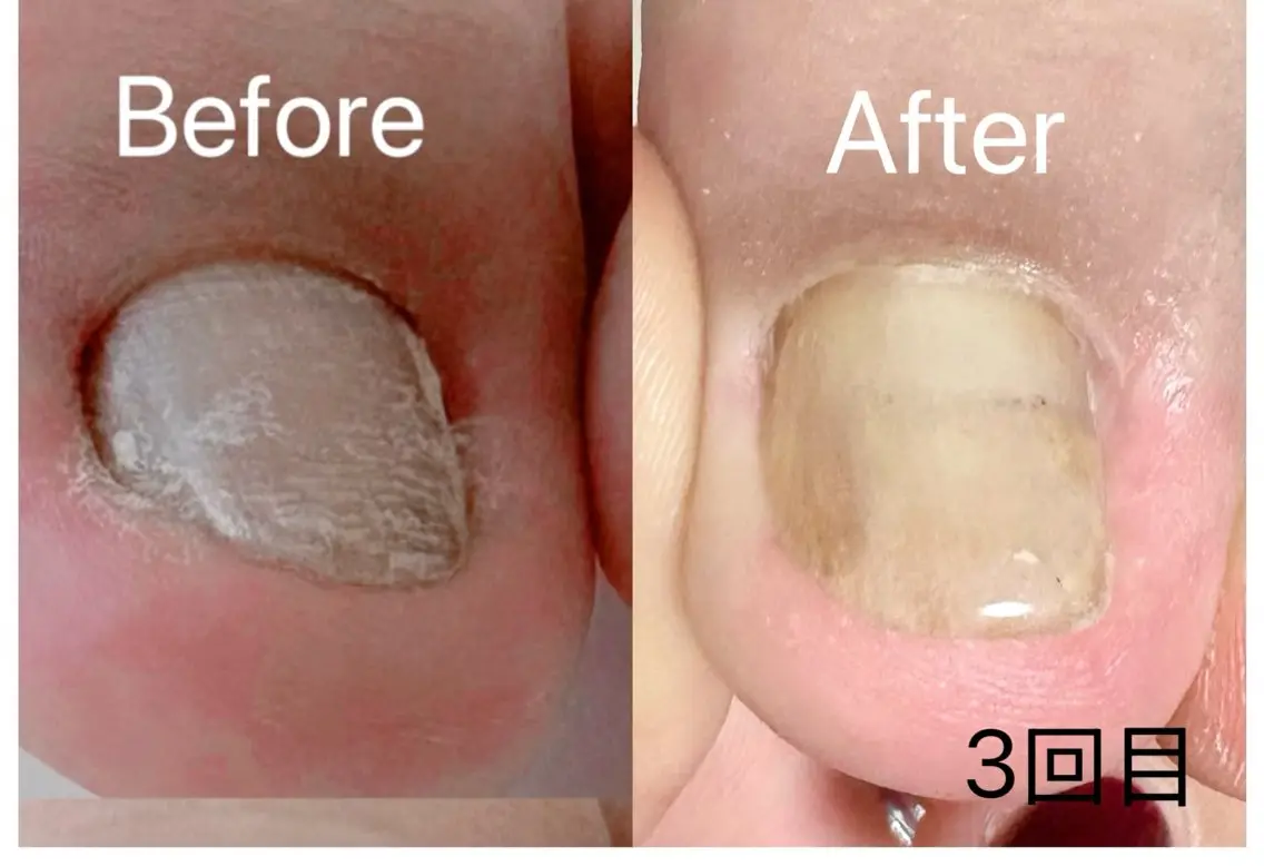 ネイル フットネイル Nagi  Nail 本山のネイルデザイン