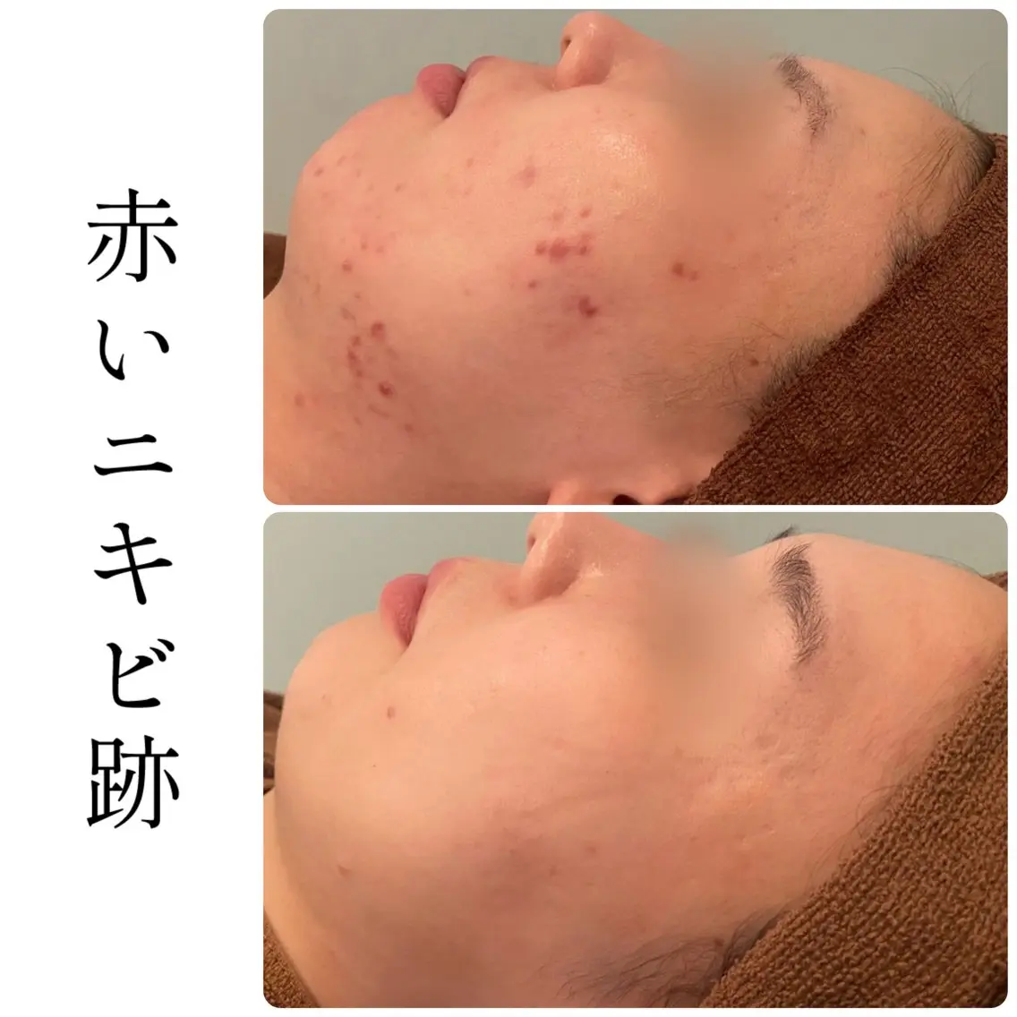 エステ ハーブピーリング専門 BIOEL横浜のエステ・リラクイメージ