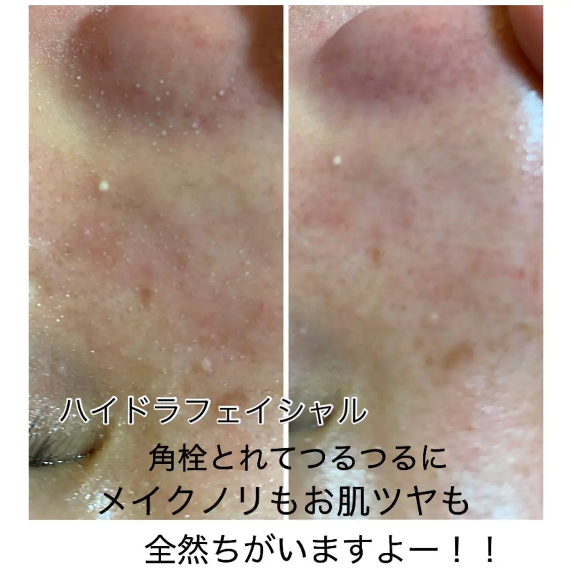 エステ 毛穴洗浄美肌プリート Pulitoのエステ・リラクイメージ
